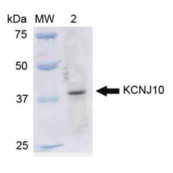 KCNJ10 Antibody, Novus Biologicals 100 &mu;g | Buy Online | Bio-Techne | Fisher Scientific